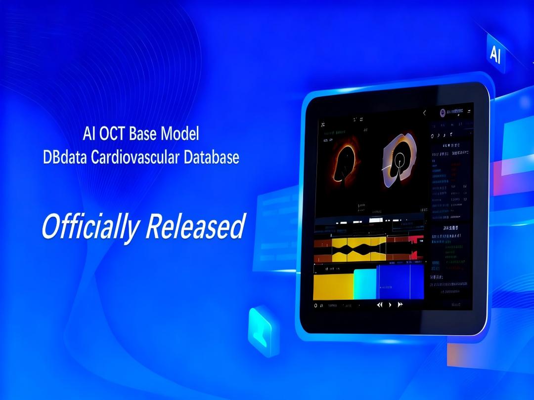 Wir folgen nicht – wir definieren! Chinas intravaskuläre Bildgebung tritt in ihr „DeepSeek“-Zeitalter ein: Vivolight Medical bringt sein KI-OCT-System auf den Markt.