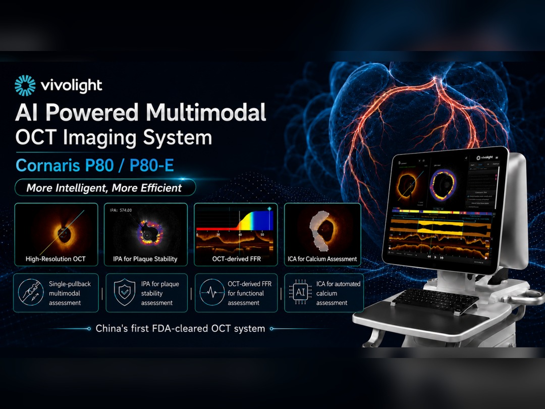 IVUS/OCT-gesteuerte PCI: Was 8 große randomisierte Studien uns sagen